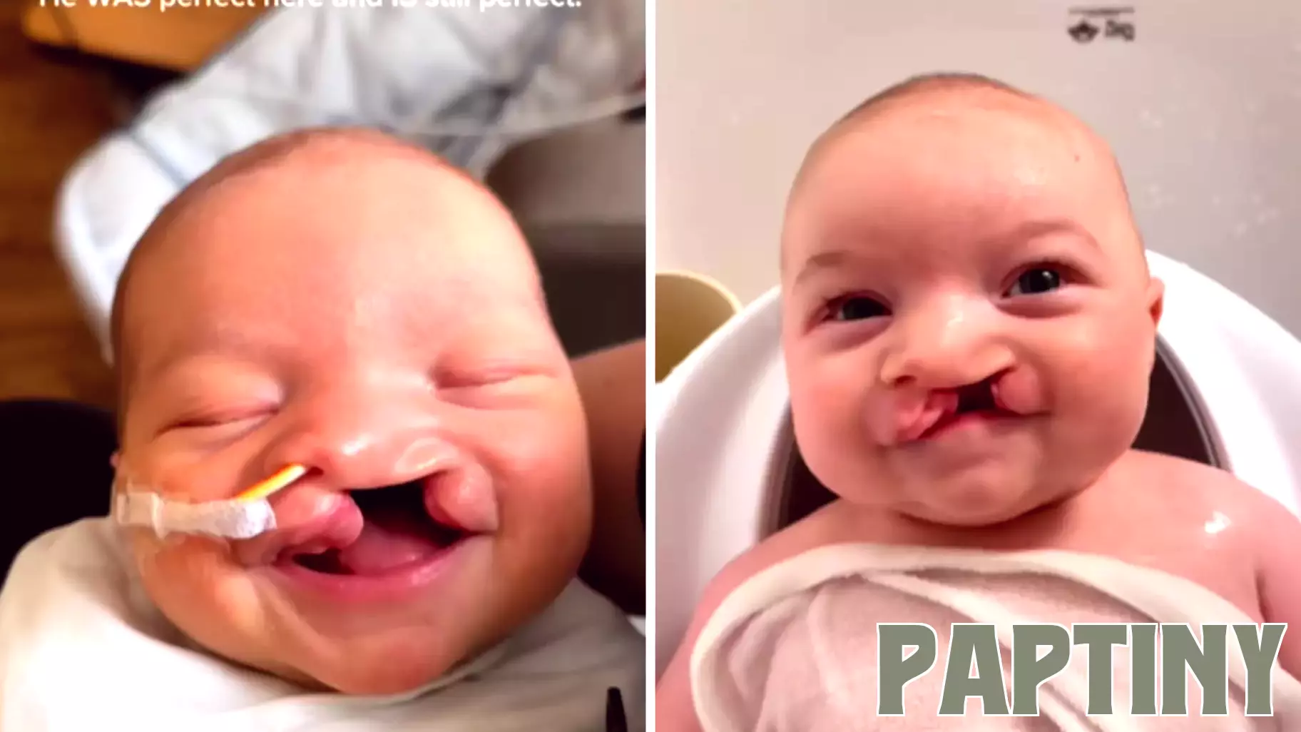 A Mother's Heartbreaking Decision at 20 Weeks